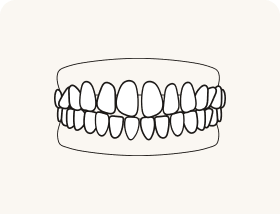 Gapped teeth